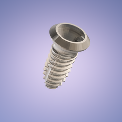 fdsdfds.png Fichier STL Implant dentaire・Plan pour imprimante 3D à télécharger