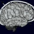 screenshot159.jpg Central nervous system cortex limbic basal ganglia stem cerebel 3D model
