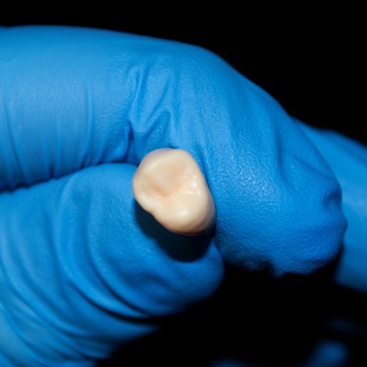 4.jpg maxillary first premolar \\ occlusal restoration model