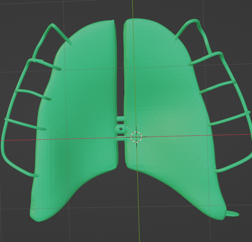 Removable-Palatal-Expansion-Appliance,-molar-distalizer,-teeth,-dental,-tooth,-palatal-expander,-app.png Aparato de Expansión Palatal Removible (KDE) en Dientes Superiores Aparato Dental