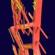 PS0053.jpg Human arterial system schematic 3D
