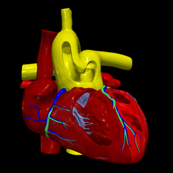 1.png Modèle 3D du tronc commun artériel Truncus Arteriosus