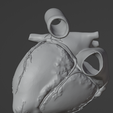 14.png 3D Model of Heart (2.3.4.5 chamber view) - 4 pack