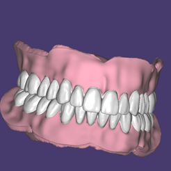 Capture.png Бесплатный STL файл Upper and lower full dentures. Teeth and bases・Шаблон для 3D-печати для загрузки