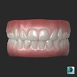 01_MAX.jpg Human teeth with gums