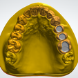 3.png Restorative model for dental students