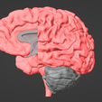 1.png 3D Model of Brain - section