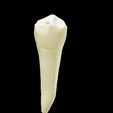 13.png First lower left first premolar #34
