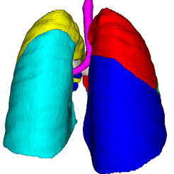 lungs1.PNG.b0799868ac161f3f078d8f8aae325d8b.png Archivo STL Modelo 3D de pulmones, vasos y vías respiratorias (a partir de un paciente real)・Modelo para descargar y imprimir en 3D, blueshirt