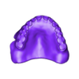 789513050_20240910_1101_Tech_01_-_H_total_B3_prerabka_1.stl DIGITAL TOTAL UPPER REMOVABLE DENTURE - 3 stl files (base + teeth + monoblock)