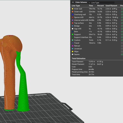 🦴 Humerus anatomy bone 3D model・ STL File for 3D printing・Cults