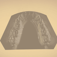 Screenshot_25.png Digital Orthodontic Study Models with Virtual Bases