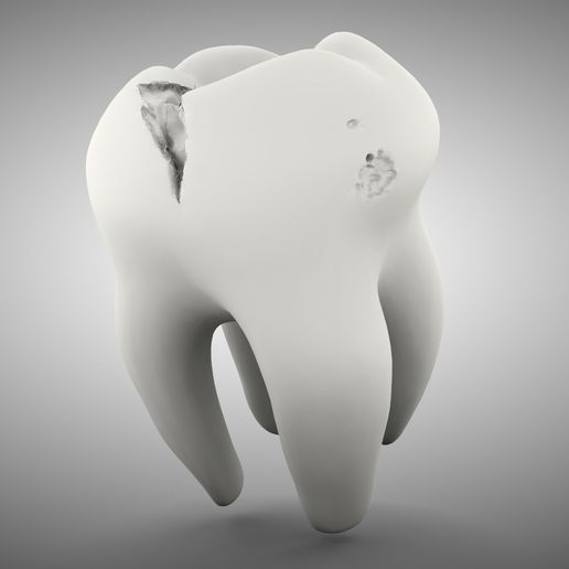 toothren.jpg Fauler Zahn