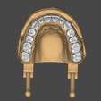 3.png Dental Model (in articulator)