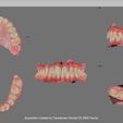 Fraire Uma 2021-04-10 11:46:05 Acquisition created by Carestream Dental CS 3600 Family BOTH MAXILLARS - SUPERIOR and INFERIOR intraoral scan (IOS) - AREA3D - Patient A. Complete DENTURE