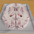 corte-transversal-render-2.png BRAIN FOR THE STUDY OF HUMAN ANATOMY, CORONAL AND TRANSVERSAL SECTIONS