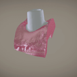 Screenshot_11.png Digital Implant Model with Soft Tissue