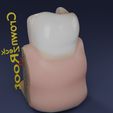 image-0020.jpg Corte esquemático de los dientes etiquetado