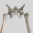 Image5.jpg STL file Hip Replacement model・3D printing design to download
