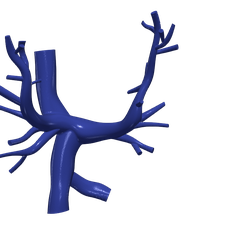 1.png Modèle 3D des artères pulmonaires (procédure Fontan)