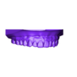 denisse camacho_maxillar_based.stl Dental Model/ Dental Model