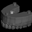 Captura de Pantalla 2020-04-02 a la(s) 19.23.51.png Dental Model with detachable teeth