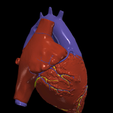 2.png 3D Model of Heart with Transposition of the Great Arteries, long axis view