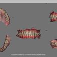 Fraire Uma 2021-04-10 11:46:17 Acquisition created by Carestream Dental CS 3600 Family BOTH MAXILLARS - SUPERIOR and INFERIOR intraoral scan (IOS) - AREA3D - Patient A. Complete DENTURE