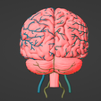 4.png 3D Model of Brain and Aneurysm
