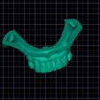 WhatsApp-Image-2024-04-18-at-19.27.08.jpeg dental model chrome denture with grinding