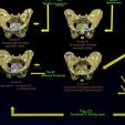 pelvis-fracture-classifications-3d-model-blend-42.jpg Pelvis fracture classifications 3D model