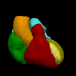 1.png Modèle de cœur en 3D - généré à partir d'un patient réel
