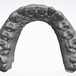Occlusal-View.png STL-Datei Oberkieferbogen 1・3D-druckbare Vorlage zum herunterladen