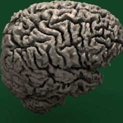 slicer3D_human_brain_display_large_display_large.jpg Human Brain