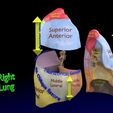 lung-pulmonary-segment-anatomy-3d-model-blend-30.jpg Lung Pulmonary segment anatomy 3D model