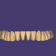 Screenshot-2026-08-23-173259.png DA2600 Library for Exocad