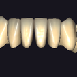 Screenshot-2024-12-31-235335.png All Collection For exocad