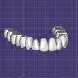Dentes-Maxila-Ashortia-Exocad.jpg Teeth Maxilla - Ashortia - Exocad