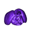 heart with transposition of great arteries.obj 3D Model of Transposition of the Great Arteries Open Duct