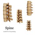 E6B0082A-4626-4582-854C-43F452055DE2.jpeg Anatomical  Spine model