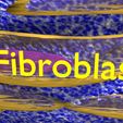 file-2.jpg Caseating granuolma tuberculosis labelled 3D model