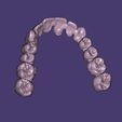 Capture1.jpg STL-Datei Dental Bridge FULL ARCH・Design zum Herunterladen und 3D-Drucken