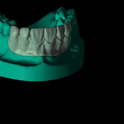 Screenshot_11.png STL-Datei Phantom-Dentalmodell für Zahntechniker・3D-druckbares Modell zum Herunterladen