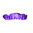 LabMagic_3D_CAD_20160420_1542_LabMagic_3D ME4D5A0CD982094CA49F4EFE1556849E2D 2.stl STL file Digital Full Dentures・3D printer model to download