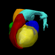 2.png 3D Heart Model - generated from real patient