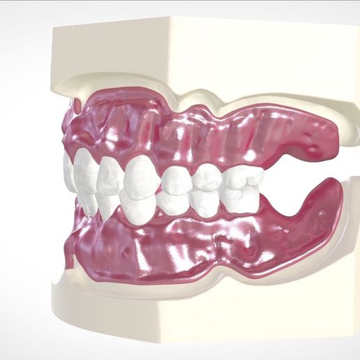 16.jpg Download OBJ file Digital Full Dentures for Gluedin Teeth with Manual Reduction • 3D printable design, LabMagic3DCAD