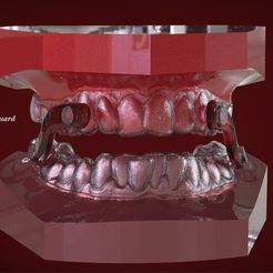 1.jpg STL file Digital Sleep Apnea Mouthguard・3D printing template to download