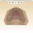 Screenshot_5.png Digital Orthodontic Study Models with Virtual Bases