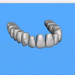 Dentes-Maxila-Ashortia-Exocad-01.jpg STL file Teeth Maxilla - Ashortia - Exocad・3D printer model to download