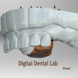 Screenshot_10.png Digital RPD Frame (Partial Denture)